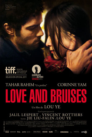 Imagen de Love and Bruises